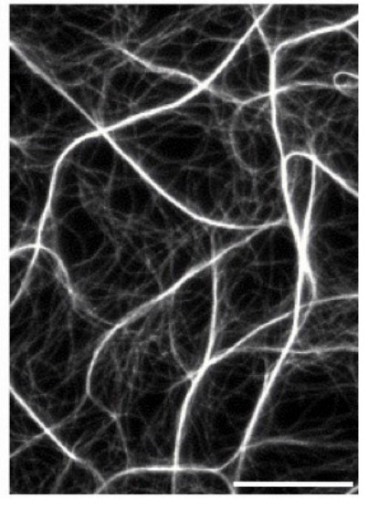 Actin filaments (1 μM) polymerized in the presence of recombinant CRP2.jpg